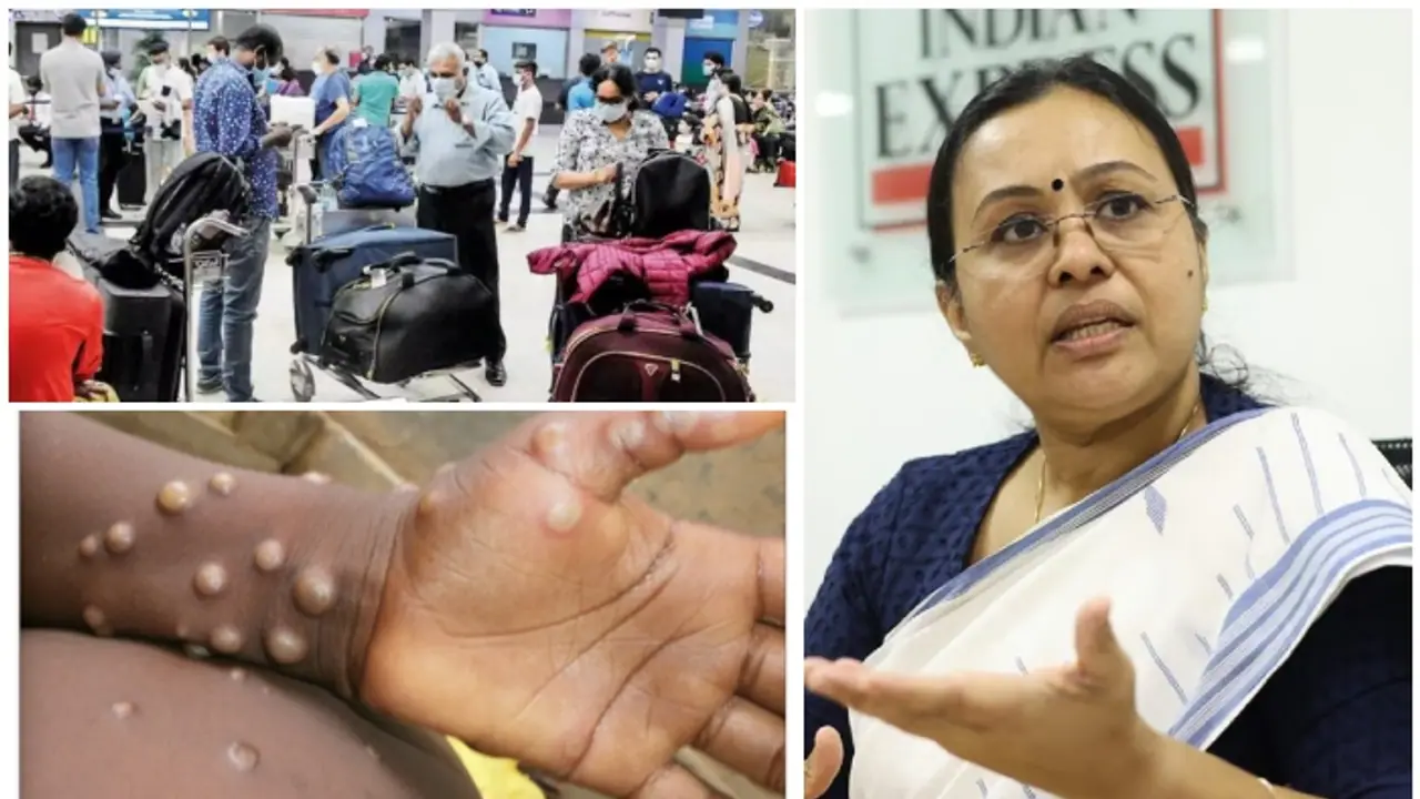 Mpox in Kerala: Health Minister Veena George urges people with symptoms to seek medical attention immediately