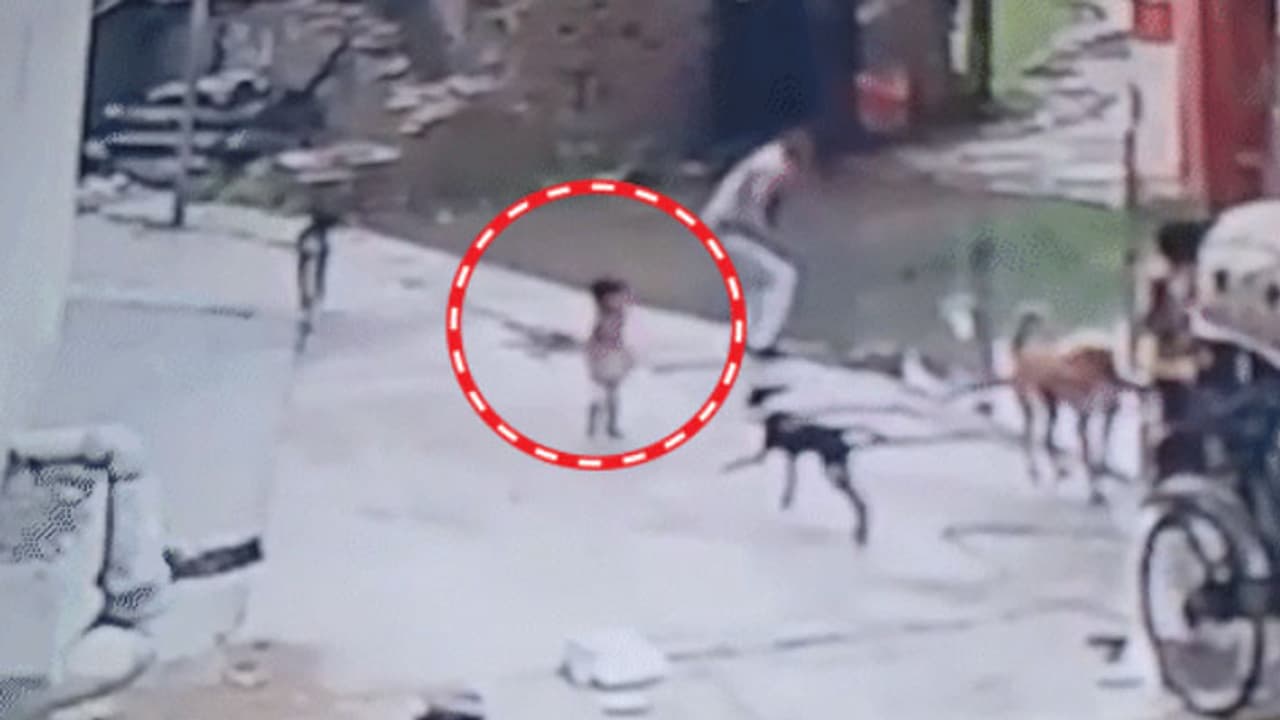 Rajasthan: 5 year old boy brutally attacked by stray dogs in Kota; check details