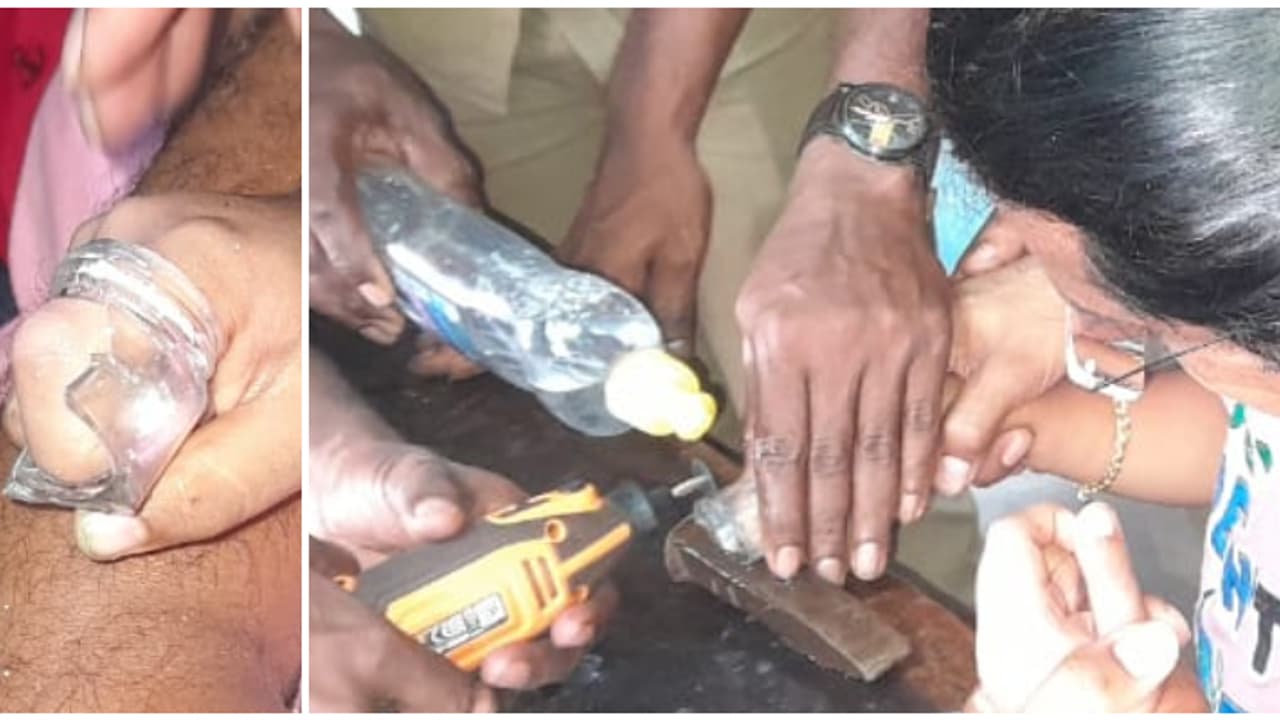 6 വയസുകാരിയുടെ ചൂണ്ടുവിരൽ ചില്ലുകുപ്പിയിൽ, ഏറെ പണിപ്പെട്ടിട്ടും പുറത്തെടുക്കാനായില്ല; രക്ഷക്കെത്തി ഫയർഫോഴ്സ് 6 വയസുകാരിയുടെ ചൂണ്ടുവിരൽ ചില്ലുകുപ്പിയിൽ, ഏറെ പണിപ്പെട്ടിട്ടും പുറത്തെടുക്കാനായില്ല; രക്ഷക്കെത്തി ഫയർഫോഴ്സ്