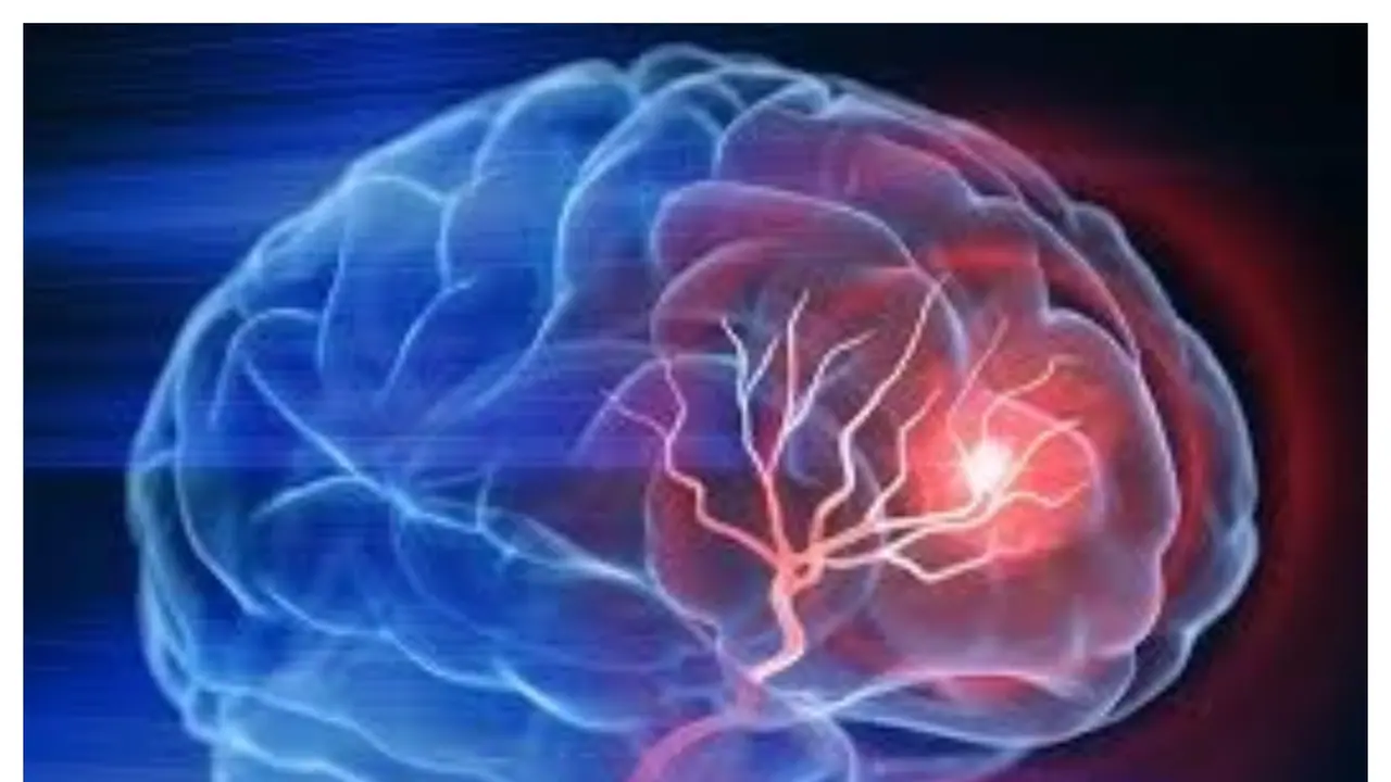 Rising Stroke Rates among Youth: A Call for Action by PM Modi's Campaign Rising Stroke Rates among Youth: A Call for Action by PM Modi's Campaign