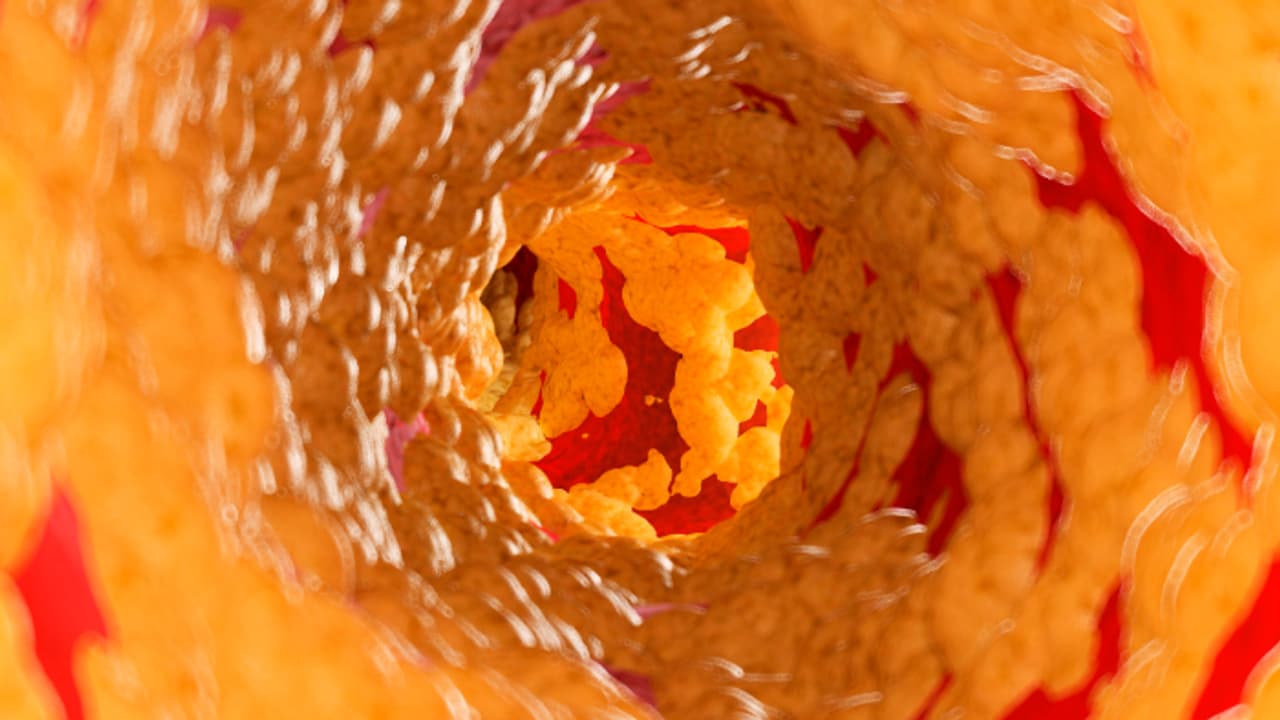 ചീത്ത കൊളസ്ട്രോളും അടിവയറിലെ കൊഴുപ്പും കുറയ്ക്കാന്‍ സഹായിക്കും ഈ അഞ്ച് എണ്ണകള്‍