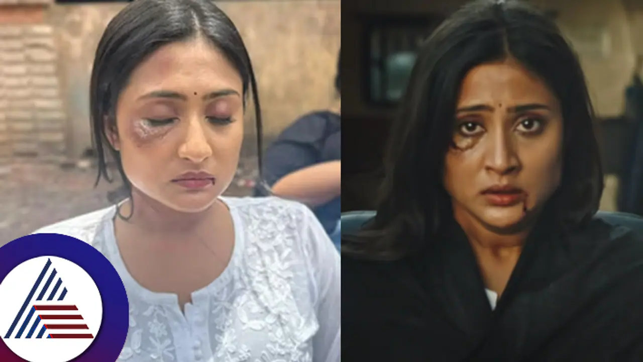 ನಟಿ ಅಮೃತಾ ಅಯ್ಯಂಗಾರ್​ಗೆ ಇದೇನಾಯ್ತು? ಸೋಷಿಯಲ್​ ಮೀಡಿಯಾ ಪೋಸ್ಟ್​ ನೋಡಿ ಫ್ಯಾನ್ಸ್​ ಶಾಕ್​ 