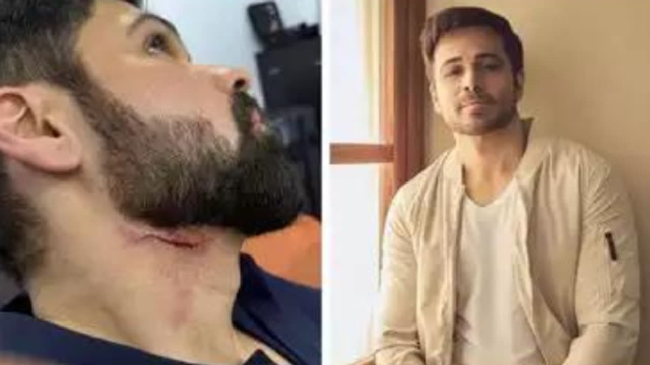 ഇമ്രാൻ ഹാഷ്‍മിക്ക് പരുക്കേറ്റു, ആക്ഷൻ രംഗത്തിന്റെ ചിത്രീകരണത്തിനിടെയാണ് അപകടം