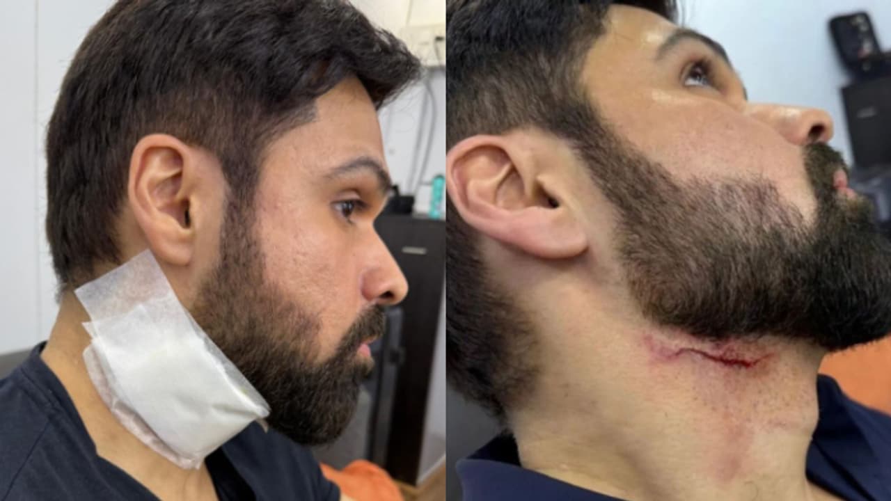 Emraan Hashmi suffers neck injury on the sets of his upcoming film 'Goodachari 2' Emraan Hashmi suffers neck injury on the sets of his upcoming film 'Goodachari 2'