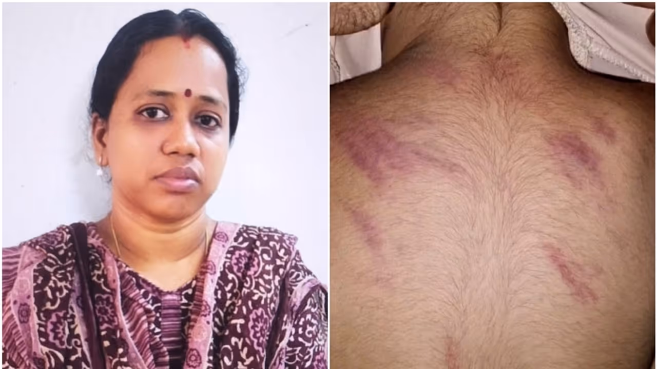 എൽകെജി വിദ്യാർത്ഥിയെ മർദ്ദിച്ച അധ്യാപിക സീതാലക്ഷ്മിയെ പിരിച്ചുവിട്ടു 