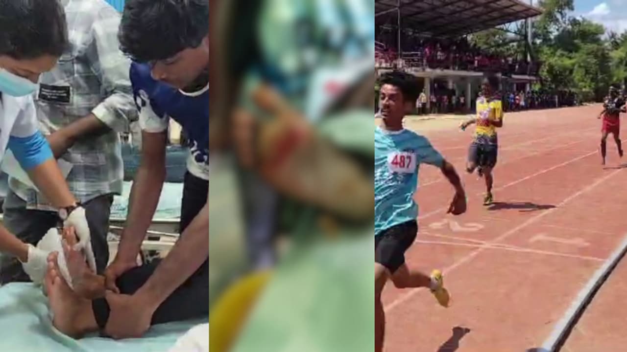 സ്പൈക്ക് ഇല്ലാതെ സിന്തറ്റിക് ട്രാക്കിൽ ഓടിയ കുട്ടികളുടെ കാലിലെ തൊലി അടർന്നു, സംഭവം ഉപജില്ലാ കായിക മേളക്കിടെ സ്പൈക്ക് ഇല്ലാതെ സിന്തറ്റിക് ട്രാക്കിൽ ഓടിയ കുട്ടികളുടെ കാലിലെ തൊലി അടർന്നു, സംഭവം ഉപജില്ലാ കായിക മേളക്കിടെ