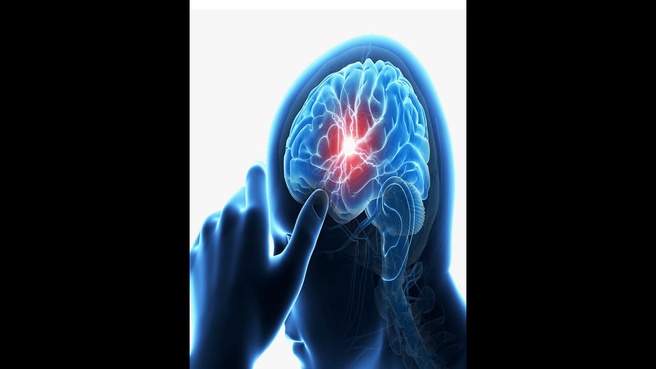 തലച്ചോറിൽ വൈദ്യുത ഉത്തേജനം നൽകിയാൽ മതി; നട്ടെല്ലിന് പരിക്കുള്ളയാൾക്ക് സിംപിളായി നടക്കാമെന്ന് പഠനങ്ങൾ