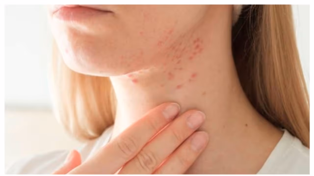 കഴുത്തിൽ കുരുക്കൾ ഉണ്ടോ? കാരണങ്ങൾ ഇതാകാം