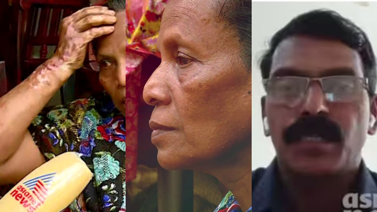 പേടിയാണ് ഗ്രേസിക്ക്..., കളമശ്ശേരി സ്ഫോടനത്തിന് ഇന്ന് ഒരു വര്ഷം; നടുക്കുന്ന ഓര്മയിൽ കാളിയാറിലെ ഗ്രേസി ഡോളി പേടിയാണ് ഗ്രേസിക്ക്..., കളമശ്ശേരി സ്ഫോടനത്തിന് ഇന്ന് ഒരു വര്ഷം; നടുക്കുന്ന ഓര്മയിൽ കാളിയാറിലെ ഗ്രേസി ഡോളി