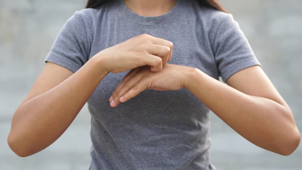 World Psoriasis Day 2024: സോറിയാസിസിന്‍റെ ഈ ലക്ഷണങ്ങളെ തിരിച്ചറിയാതെ പോകരുത്