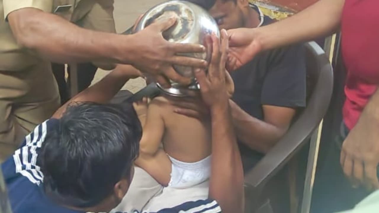 ഒന്നര വയസുകാരിയുടെ തലയിൽ പാത്രം കുടുങ്ങി, എറെ ശ്രമിച്ചും ഊരാനായില്ല, മണിക്കൂറുകൾ പരിശ്രമിച്ച് മുറിച്ചുമാറ്റി ഒന്നര വയസുകാരിയുടെ തലയിൽ പാത്രം കുടുങ്ങി, എറെ ശ്രമിച്ചും ഊരാനായില്ല, മണിക്കൂറുകൾ പരിശ്രമിച്ച് മുറിച്ചുമാറ്റി