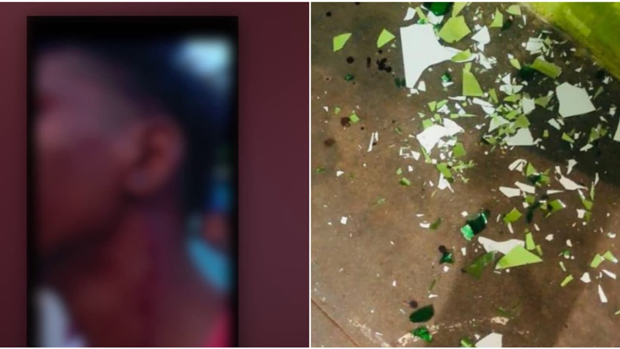 അശ്രദ്ധമായി കാറോടിച്ചത് ചോദ്യംചെയ്ത ദലിത് വിദ്യാർത്ഥിക്ക് ക്രൂരമർദനം; ബിയർ കുപ്പി കൊണ്ട് തലയ്ക്കടിച്ചു അശ്രദ്ധമായി കാറോടിച്ചത് ചോദ്യംചെയ്ത ദലിത് വിദ്യാർത്ഥിക്ക് ക്രൂരമർദനം; ബിയർ കുപ്പി കൊണ്ട് തലയ്ക്കടിച്ചു