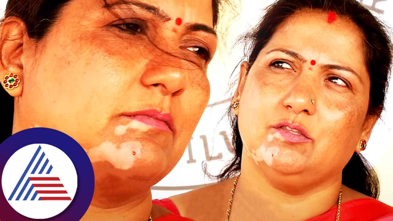 ಖ್ಯಾತ ನಟಿ ಶಶಿಕಲಾ ಮುಖದ ಮೇಲೆ ಕಲೆ ಆಗೋಕೆ ಈ ಚಿತ್ರತಂಡವೇ ಕಾರಣ! ಖ್ಯಾತ ನಟಿ ಶಶಿಕಲಾ ಮುಖದ ಮೇಲೆ ಕಲೆ ಆಗೋಕೆ ಈ ಚಿತ್ರತಂಡವೇ ಕಾರಣ!