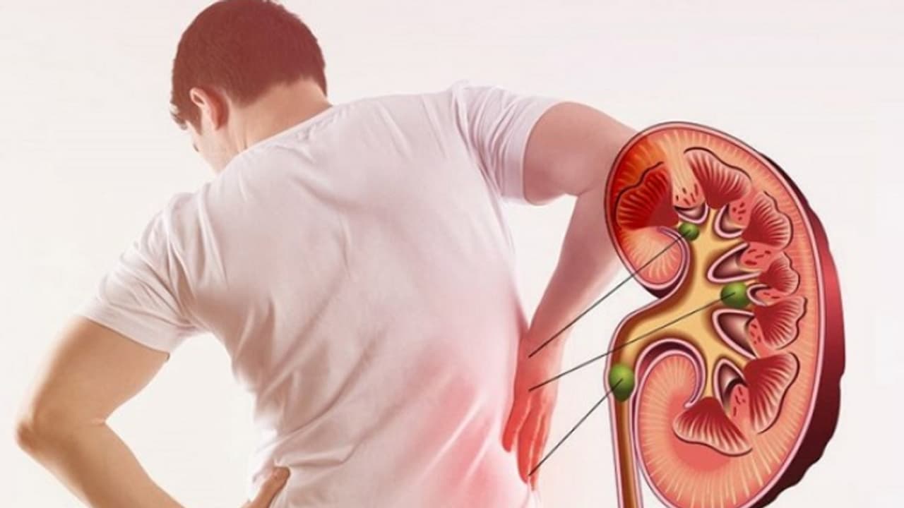 Health Tips: വൃക്കയിലെ കല്ലുകളെ തടയാൻ ചെയ്യേണ്ട കാര്യങ്ങള് Health Tips: വൃക്കയിലെ കല്ലുകളെ തടയാൻ ചെയ്യേണ്ട കാര്യങ്ങള്