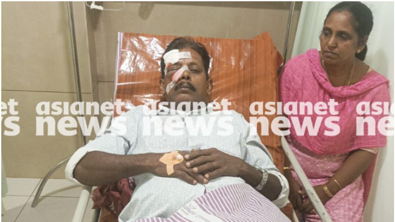 താമരശ്ശേരിയിൽ തെങ്ങിൻ മുകളിൽ ഒരു കുരങ്ങ്, കരിക്ക് പറിച്ച് കർഷകന് നേരെ ഒറ്റയേറ്; തലയ്ക്കും മുഖത്തും പരിക്കേറ്റു