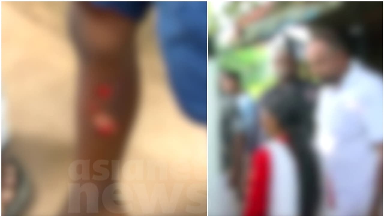 4 വയസുകാരനെ സ്പൂൺ ചൂടാക്കി പൊള്ളിച്ചെന്ന് പരാതി; അമ്മയ്ക്കെതിരെ പൊലീസ് കേസെടുത്തു 4 വയസുകാരനെ സ്പൂൺ ചൂടാക്കി പൊള്ളിച്ചെന്ന് പരാതി; അമ്മയ്ക്കെതിരെ പൊലീസ് കേസെടുത്തു