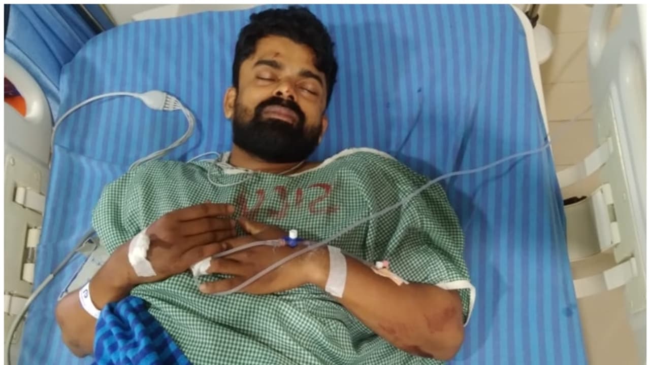 പാലക്കാട് ഹോട്ടൽ ജീവനക്കാരൻ ജോലി കഴിഞ്ഞ് വീട്ടിലേയ്ക്ക് മടങ്ങവേ ബൈക്കിന് കുറുകെ കാട്ടുപന്നി ചാടി, പരിക്ക് പാലക്കാട് ഹോട്ടൽ ജീവനക്കാരൻ ജോലി കഴിഞ്ഞ് വീട്ടിലേയ്ക്ക് മടങ്ങവേ ബൈക്കിന് കുറുകെ കാട്ടുപന്നി ചാടി, പരിക്ക്