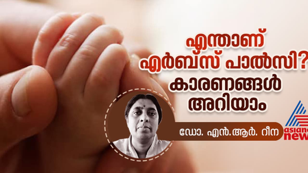 '2000 പ്രസവങ്ങൾ നടക്കുമ്പോൾ ഏതാണ്ട് മൂന്ന് കുട്ടികളിൽ വരെ ഉണ്ടാകാൻ സാധ്യതയുള്ള വൈകല്യമാണ് എർബ്സ് പാൽസി ' '2000 പ്രസവങ്ങൾ നടക്കുമ്പോൾ ഏതാണ്ട് മൂന്ന് കുട്ടികളിൽ വരെ ഉണ്ടാകാൻ സാധ്യതയുള്ള വൈകല്യമാണ് എർബ്സ് പാൽസി '
