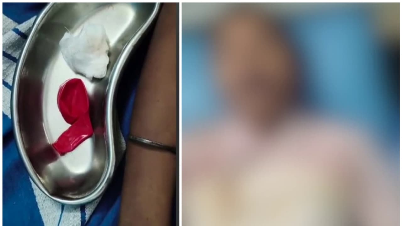 വീർപ്പിക്കുന്നതിനിടെ ബലൂൺ തൊണ്ടയിൽ കുടുങ്ങി, 13 വയസുകാരന് ദാരുണാന്ത്യം വീർപ്പിക്കുന്നതിനിടെ ബലൂൺ തൊണ്ടയിൽ കുടുങ്ങി, 13 വയസുകാരന് ദാരുണാന്ത്യം