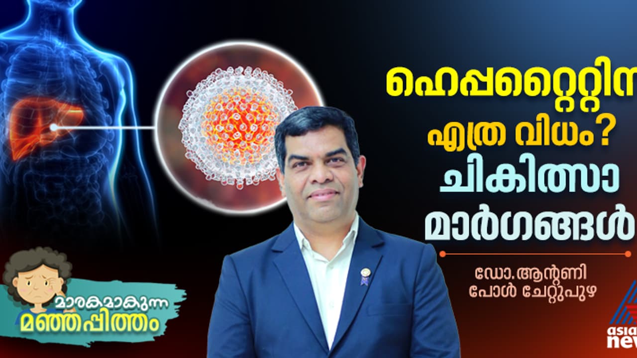 മഞ്ഞപ്പിത്തം എത്ര വിധം? ചികിത്സാ മാർഗങ്ങൾ എന്തൊക്കെ? : ഡോ. ആന്റണി പോൾ ചേറ്റുപുഴ എഴുതുന്നു മഞ്ഞപ്പിത്തം എത്ര വിധം? ചികിത്സാ മാർഗങ്ങൾ എന്തൊക്കെ? : ഡോ. ആന്റണി പോൾ ചേറ്റുപുഴ എഴുതുന്നു