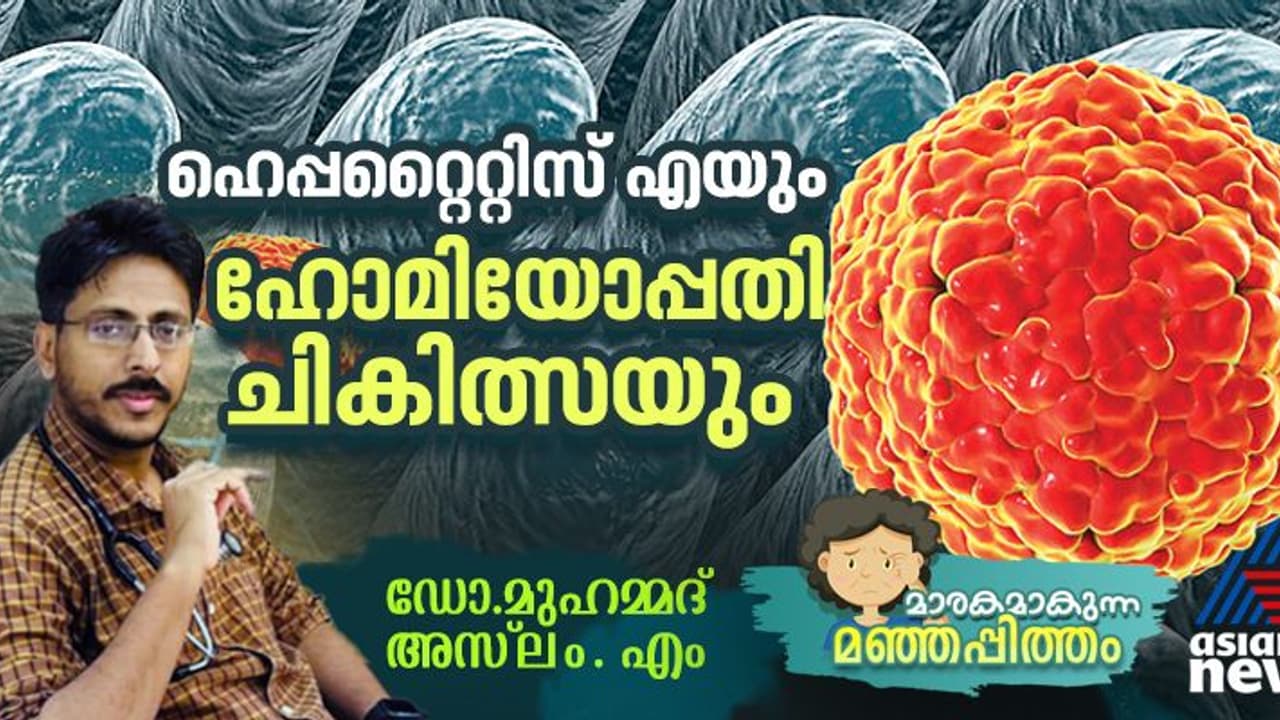 ഹെപ്പറ്റൈറ്റിസ് എ പകരുന്നത് എങ്ങനെ? രോ​ഗലക്ഷണങ്ങൾ എന്തൊക്കെ? : ഡോ. മുഹമ്മദ് അസ്‌ലം. എം എഴുതുന്നു