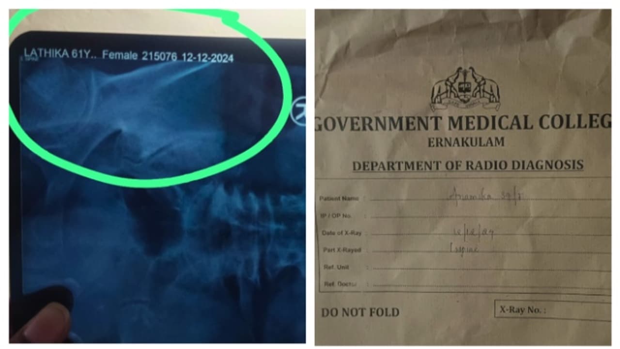 34കാരിക്ക് മരുന്ന് നൽകിയത് 64കാരിയുടെ എക്സ്റേ പ്രകാരം; കളമശ്ശേരി മെഡിക്കൽ കോളേജിൽ ചികിത്സാപ്പിഴവെന്ന് പരാതി