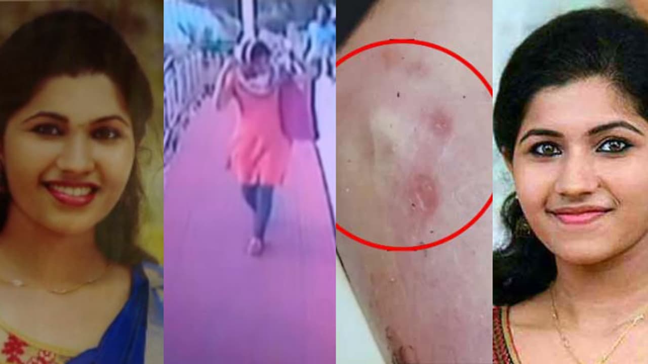 'മുഖത്തും ശരീരത്തിലും നഖം കൊണ്ട പാട്, ചുണ്ടിൽ മുറിവ്'; 7 വർഷമായി, മിഷേലിന്റെ മരണത്തിൽ നീതി കാത്ത് കുടുംബം 'മുഖത്തും ശരീരത്തിലും നഖം കൊണ്ട പാട്, ചുണ്ടിൽ മുറിവ്'; 7 വർഷമായി, മിഷേലിന്റെ മരണത്തിൽ നീതി കാത്ത് കുടുംബം