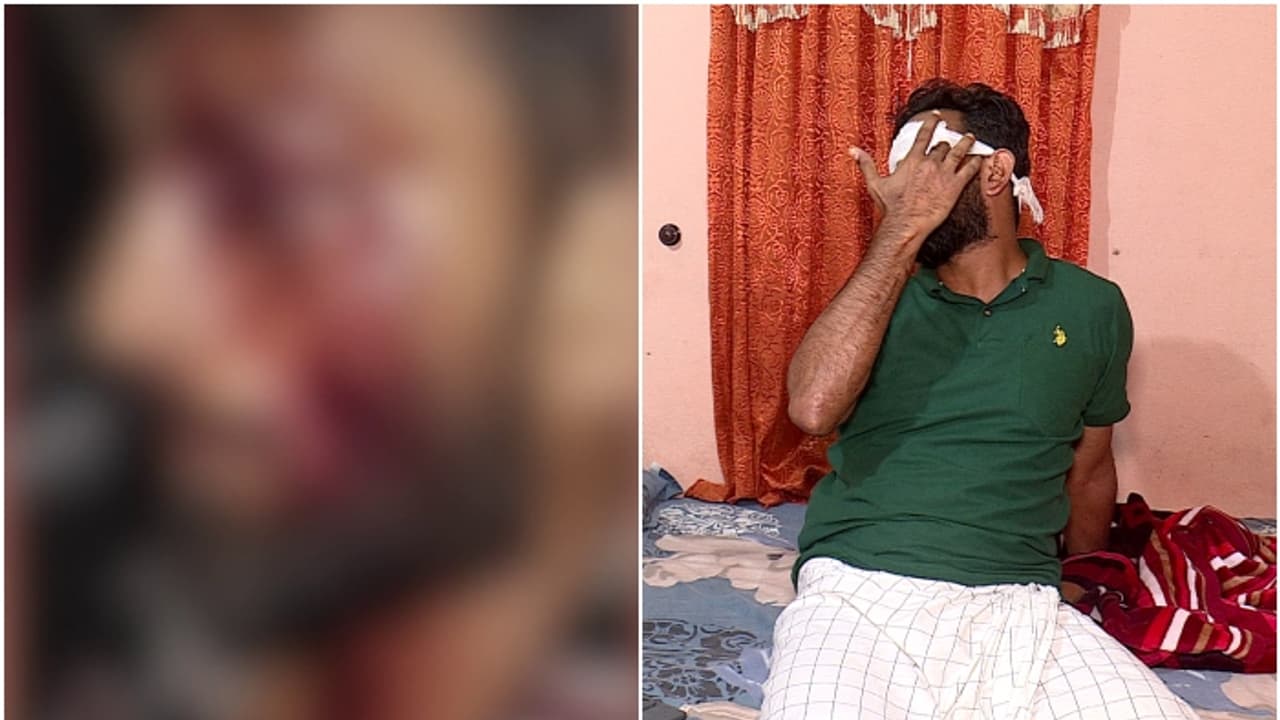 മലപ്പുറത്ത് യുവാവിന് നേരെ ആൾക്കൂട്ട ആക്രമണം; ക്രൂരമർദനം വാഹനം നടുറോഡില് നിര്ത്തിയത് ചോദ്യം ചെയ്തതിന് മലപ്പുറത്ത് യുവാവിന് നേരെ ആൾക്കൂട്ട ആക്രമണം; ക്രൂരമർദനം വാഹനം നടുറോഡില് നിര്ത്തിയത് ചോദ്യം ചെയ്തതിന്