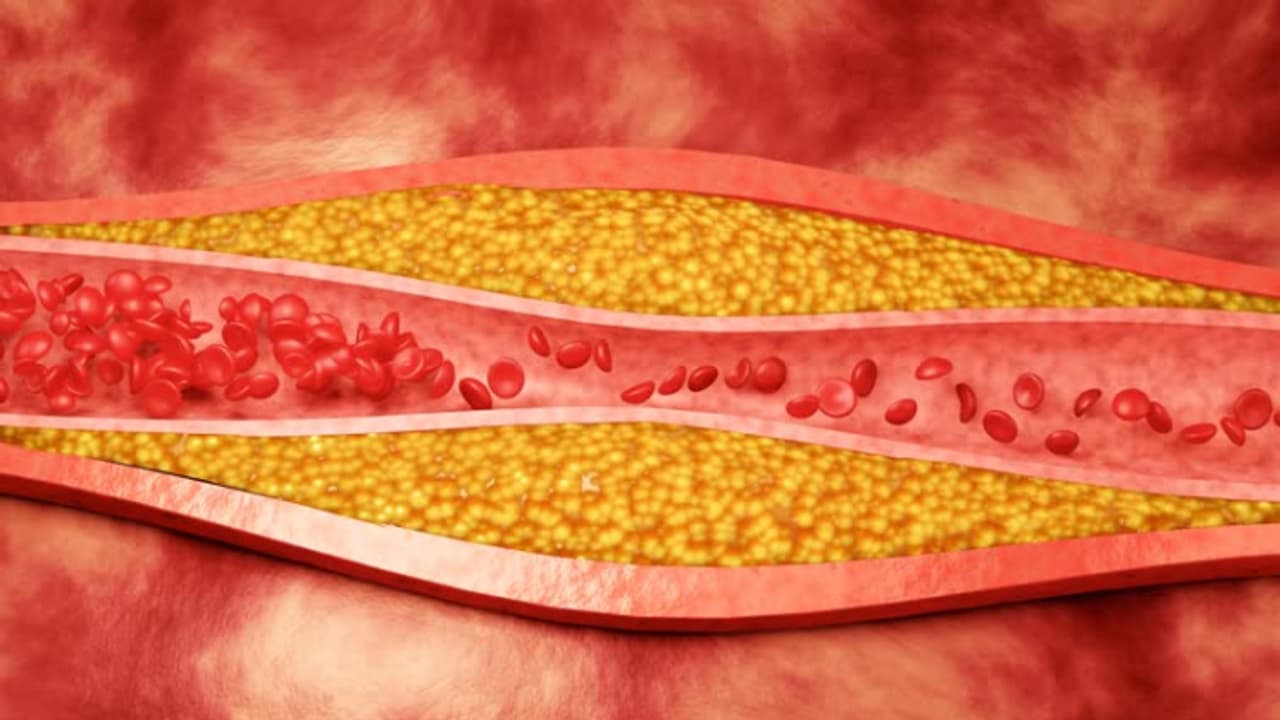 നല്ല കൊളസ്ട്രോൾ അഥവാ എച്ച്ഡിഎല്‍ കൊളസ്‌ട്രോള്‍ കൂട്ടാന്‍ സഹായിക്കുന്ന നട്സും ഡ്രൈ ഫ്രൂട്ട്സും