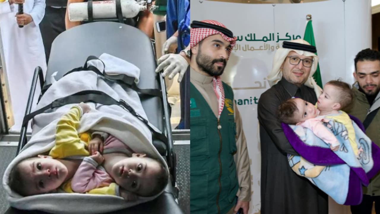 ഒരു മനസ്സാണെങ്കിലും ഇരുമെയ്യാകണം; പത്ത് മാസം പ്രായമുള്ള സെലീനും എലീനും റിയാദിലെത്തി