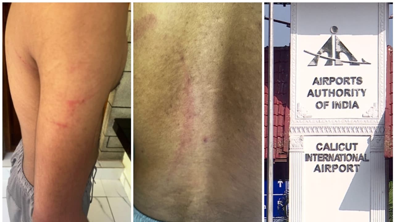 കരിപ്പൂർ വിമാനത്താവളത്തിൽ ഉംറ തീർഥാടകന് ക്രൂരമർദ്ദനമെന്ന് പരാതി; ആക്രമണത്തിന് കാരണം പാർക്കിങ് ഫീ തർക്കം