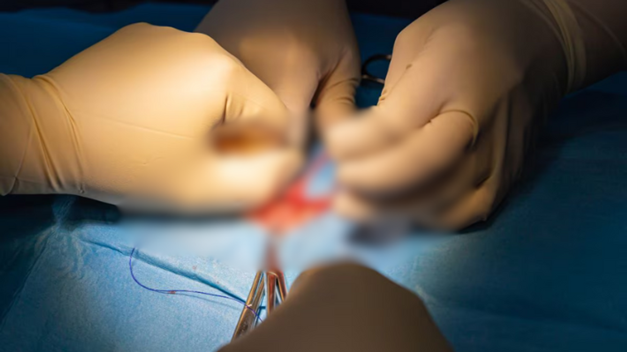 SHOCKER! 'Fake UK doctor ' causes 7 deaths from heart procedures; police register case, launch manhunt in MP