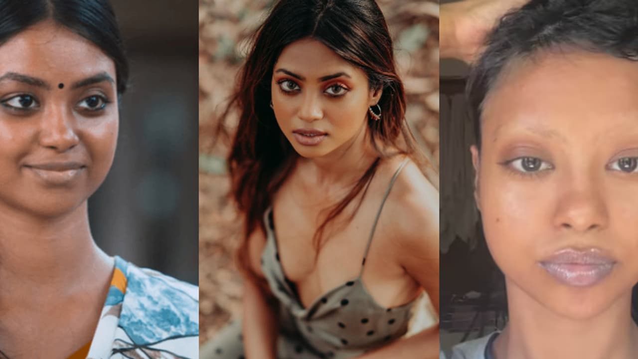 തലമുടി പോയി, തുടര്ന്ന ഇഞ്ചക്ഷന്: രോഗ അവസ്ഥ പറഞ്ഞ് 'കമ്മട്ടിപ്പാടം' നായിക ഷോണ് റോമി തലമുടി പോയി, തുടര്ന്ന ഇഞ്ചക്ഷന്: രോഗ അവസ്ഥ പറഞ്ഞ് 'കമ്മട്ടിപ്പാടം' നായിക ഷോണ് റോമി