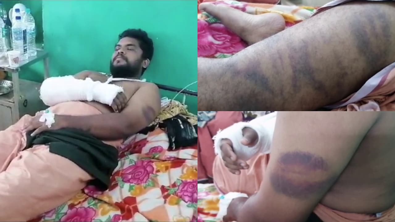 അച്ഛനും മകനും തമ്മിൽ അടി, പിടിച്ചുമാറ്റാൻ ശ്രമിച്ച് പിന്മാറിയ യുവാവിന് ആറ്റിങ്ങൽ പൊലീസിൻ്റെ മർദ്ദനം; പരാതി അച്ഛനും മകനും തമ്മിൽ അടി, പിടിച്ചുമാറ്റാൻ ശ്രമിച്ച് പിന്മാറിയ യുവാവിന് ആറ്റിങ്ങൽ പൊലീസിൻ്റെ മർദ്ദനം; പരാതി