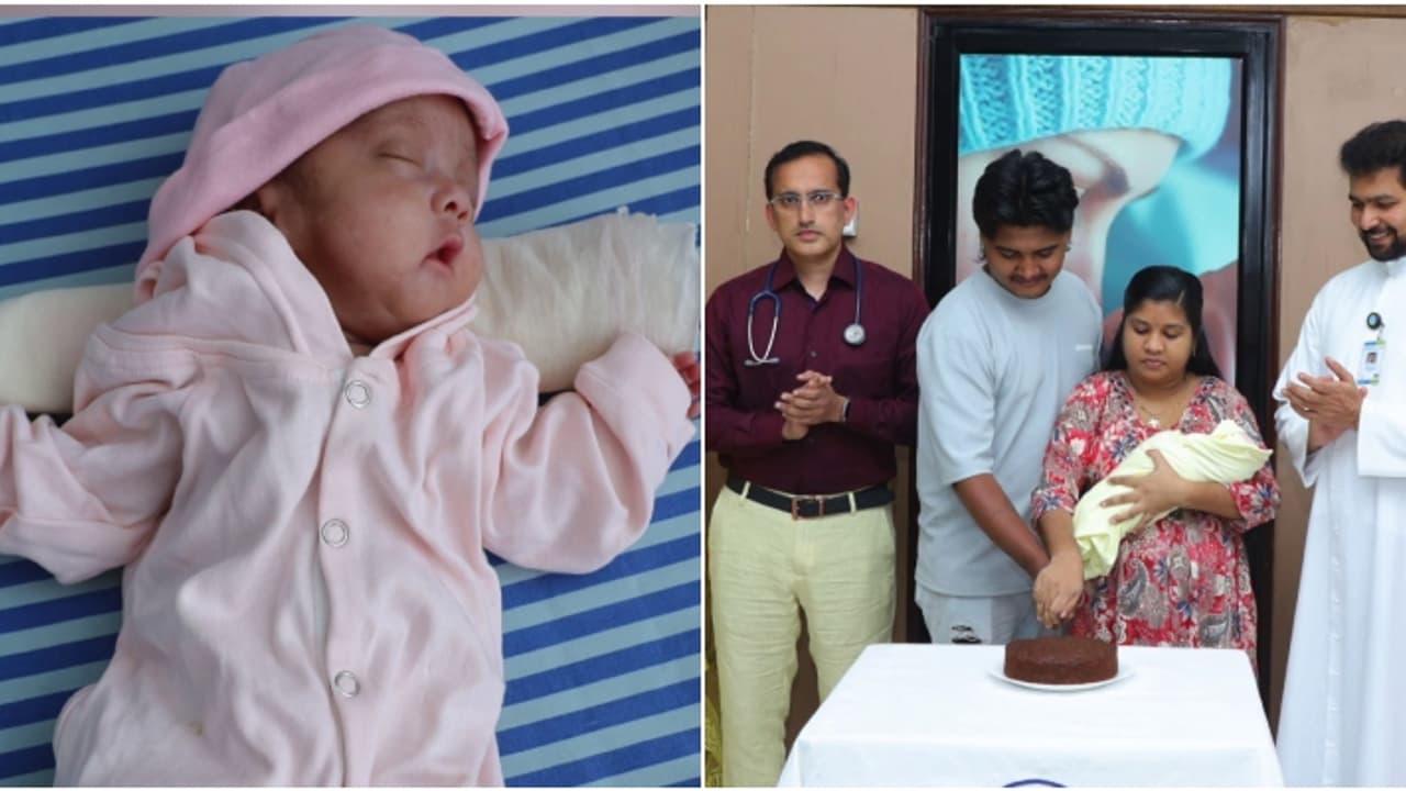 ഭാരം വെറും 350 ഗ്രാം മാത്രം, 'നോവ' ക്ക് എറണാകുളം ലൂർദ് ആശുപത്രിയിൽ പുതുജീവൻ ഭാരം വെറും 350 ഗ്രാം മാത്രം, 'നോവ' ക്ക് എറണാകുളം ലൂർദ് ആശുപത്രിയിൽ പുതുജീവൻ