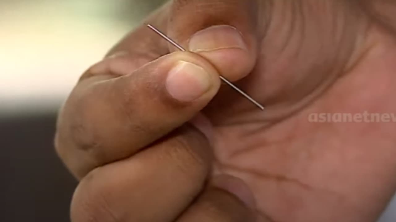 കുഞ്ഞിന്റെ കാലിൽ സൂചിക്കഷ്ണം; ഡോക്ടർക്കും നഴ്സിനുമെതിരെ കേസ്, 24 ദിവസം കാലിൽ സൂചിയുണ്ടായിരുന്നുവെന്ന് എഫ്ഐആർ കുഞ്ഞിന്റെ കാലിൽ സൂചിക്കഷ്ണം; ഡോക്ടർക്കും നഴ്സിനുമെതിരെ കേസ്, 24 ദിവസം കാലിൽ സൂചിയുണ്ടായിരുന്നുവെന്ന് എഫ്ഐആർ