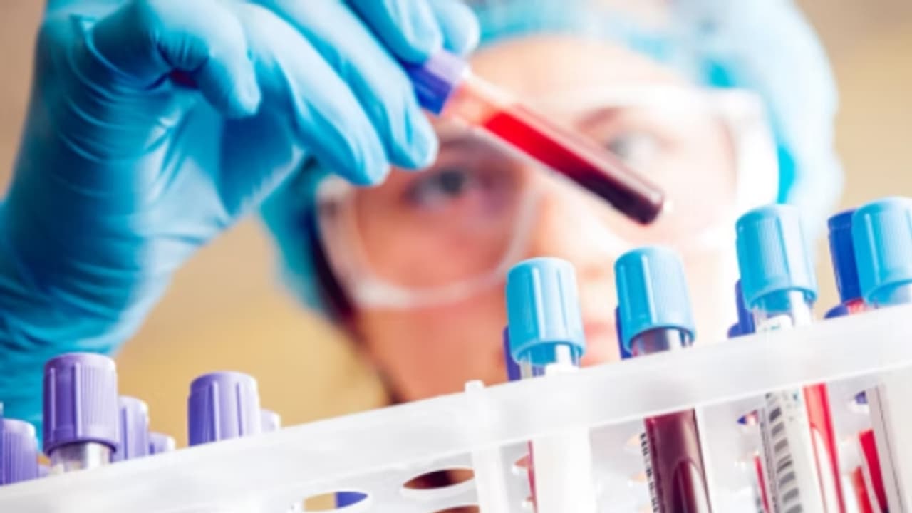 ടെസ്റ്റ് റിസൽട്ട് റിസൽട്ടിനായി ഇനി ലാബിൽ പോവേണ്ട, മൊബൈലിൽ അറിയാം; 'നിർണയ ലാബ് നെറ്റ്‍വർക്ക്' 3 മാസത്തിനുള്ളിൽ