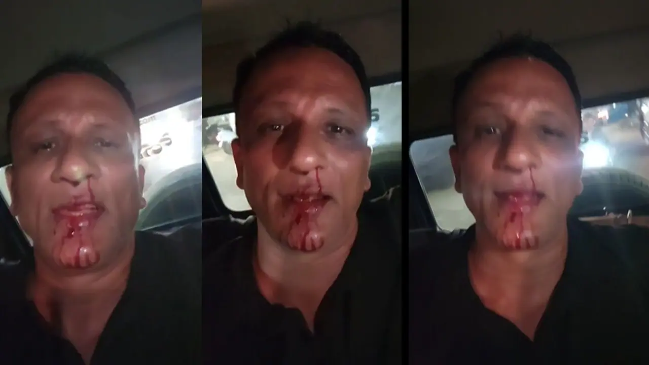 ಲಾಯರ್‌ ಜಗದೀಶ್‌ ಮೇಲೆ ಮತ್ತೆ ಹಲ್ಲೆ, ಮೂಗಿನಿಂದ ರಕ್ತ ಬರುವಂತೆ ಹೊಡೆದ ಪುಂಡರು!