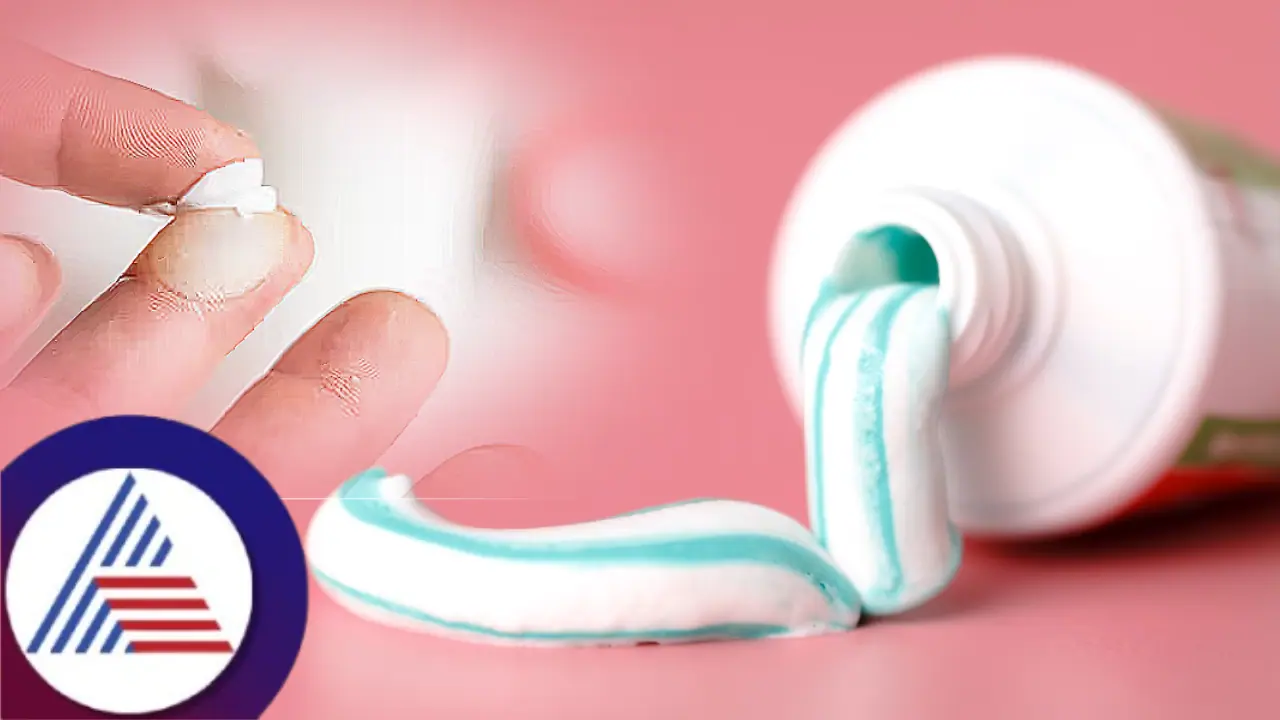 ಮೈ, ಕೈ ಸುಟ್ಟುಕೊಂಡ ತಕ್ಷಣ ಟೂತ್ ಪೇಸ್ಟ್ ಹಚ್ಚೋದು ಸರೀನಾ? ತಪ್ಪಾ?