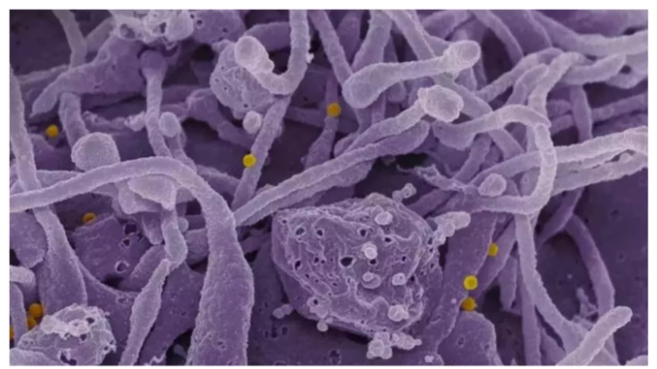 എന്താണ് കോംഗോ പനി? ലക്ഷണങ്ങൾ എന്തൊക്കെ? എന്താണ് കോംഗോ പനി? ലക്ഷണങ്ങൾ എന്തൊക്കെ?