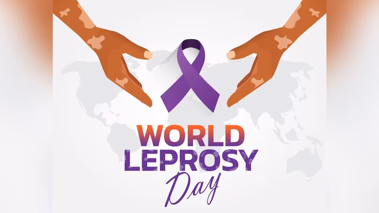 World Leprosy Day 2025 : കുഷ്ഠരോഗം ; അറിയാം രോഗലക്ഷണങ്ങൾ, പ്രതിരോധം World Leprosy Day 2025 : കുഷ്ഠരോഗം ; അറിയാം രോഗലക്ഷണങ്ങൾ, പ്രതിരോധം