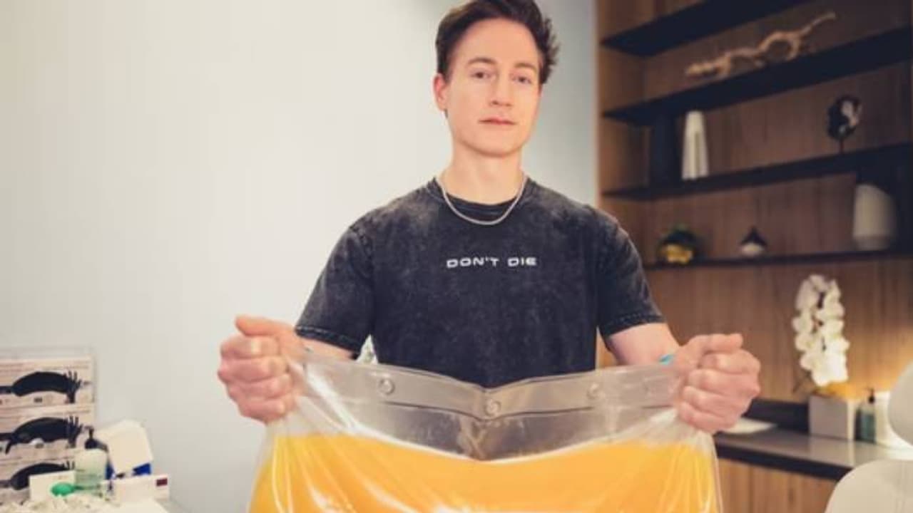 ആർക്കെങ്കിലും വേണോ? പ്രായം കുറക്കാൻ പ്ലാസ്മ തരാൻ തയ്യാറെന്ന് ടെക് കോടീശ്വരൻ, ചോദ്യങ്ങളുമായി നെറ്റിസണ്സ് ആർക്കെങ്കിലും വേണോ? പ്രായം കുറക്കാൻ പ്ലാസ്മ തരാൻ തയ്യാറെന്ന് ടെക് കോടീശ്വരൻ, ചോദ്യങ്ങളുമായി നെറ്റിസണ്സ്