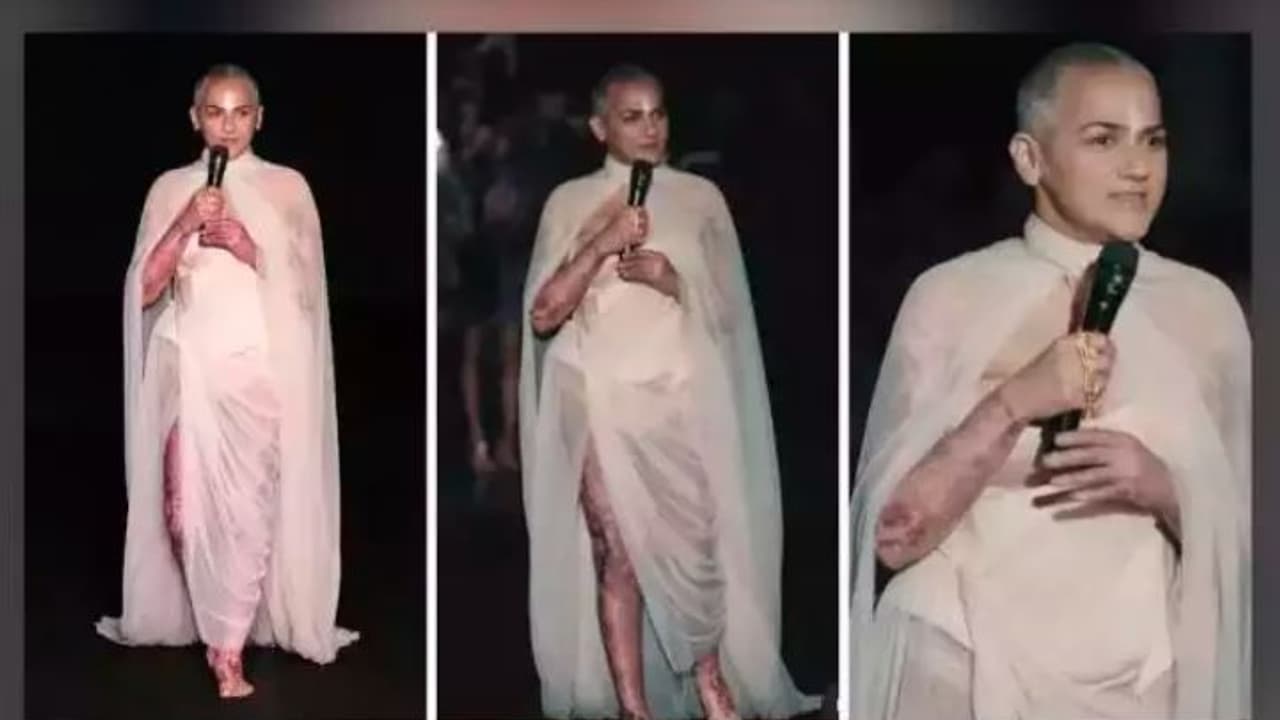 ಬೆಂಕಿಯಲ್ಲರಳಿದ ಹೂ: ಪ್ಯಾರಿಸ್ ಫ್ಯಾಷನ್ ವೀಕ್ನಲ್ಲಿ ಸುಟ್ಟ ದೇಹ ಪ್ರದರ್ಶಿಸಿದ ಮಾಡೆಲ್ ಬೆಂಕಿಯಲ್ಲರಳಿದ ಹೂ: ಪ್ಯಾರಿಸ್ ಫ್ಯಾಷನ್ ವೀಕ್ನಲ್ಲಿ ಸುಟ್ಟ ದೇಹ ಪ್ರದರ್ಶಿಸಿದ ಮಾಡೆಲ್