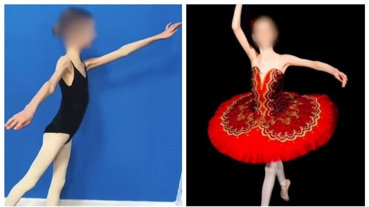 16 മത്തെ വയസിൽ 27 കിലോ മാത്രം; അച്ഛനും അമ്മയും മകളെ വർഷങ്ങളോളം പട്ടിണിക്കിട്ടത് നൃത്തത്തിന് വേണ്ടി, ഒടുവിൽ 