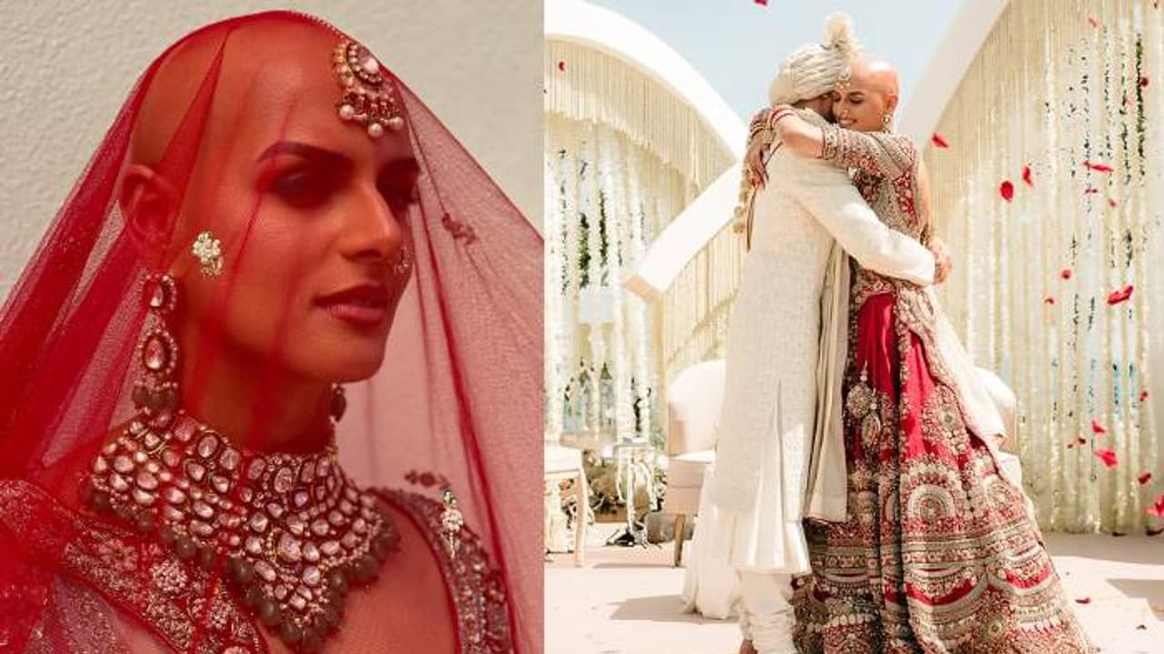 'എന്തൊരു ലുക്ക്, ഇതാണാ 'ബാൾഡ് ആൻഡ് ബ്യൂട്ടിഫുൾ' ​ഗേൾ'; മുടിയില്ലാതെ വിവാഹവേഷത്തിൽ ഞെട്ടിച്ച് യുവതി, കാരണമുണ്ട്