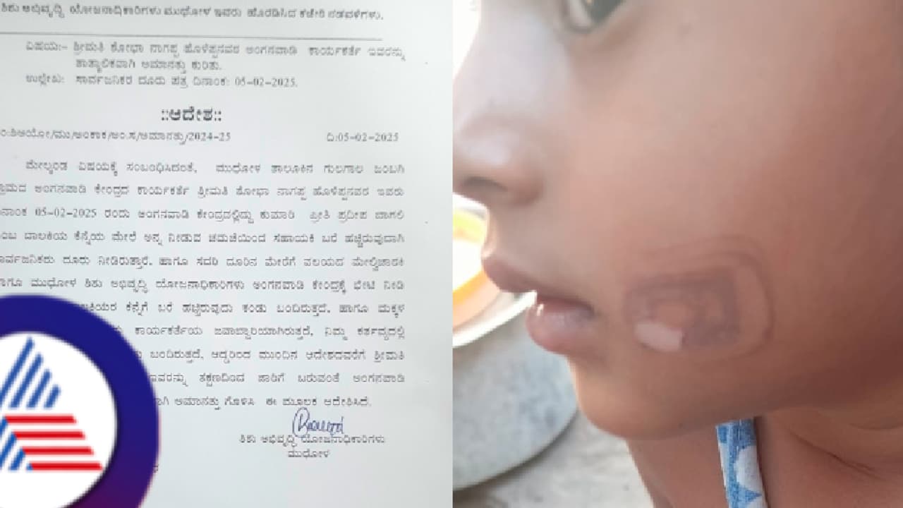 ಬಾಗಲಕೋಟೆಯಲ್ಲಿ ಅಮಾನವೀಯ ಕೃತ್ಯ; ಬಾಲಕಿ ಕೆನ್ನೆಗೆ ಅನ್ನದ ಚಮಚದಿಂದ ಬರೆ ಹಾಕಿದ ಸಹಾಯಕಿ! ಬಾಗಲಕೋಟೆಯಲ್ಲಿ ಅಮಾನವೀಯ ಕೃತ್ಯ; ಬಾಲಕಿ ಕೆನ್ನೆಗೆ ಅನ್ನದ ಚಮಚದಿಂದ ಬರೆ ಹಾಕಿದ ಸಹಾಯಕಿ!