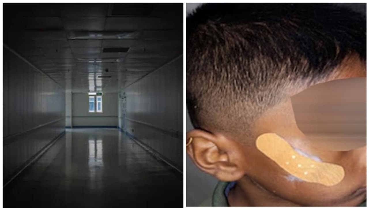 7 വയസുകാരന്റെ മുറിവിന് തുന്നലിടുന്നതിന് പകരം ഫെവിക്വിക്ക് ഉപയോഗിച്ച നഴ്സിനെ സസ്പെന്റ് ചെയ്ത് കർണാടക സർക്കാർ 7 വയസുകാരന്റെ മുറിവിന് തുന്നലിടുന്നതിന് പകരം ഫെവിക്വിക്ക് ഉപയോഗിച്ച നഴ്സിനെ സസ്പെന്റ് ചെയ്ത് കർണാടക സർക്കാർ