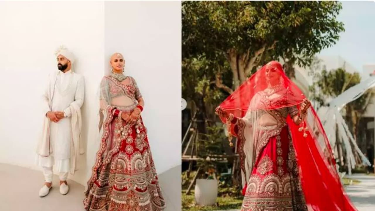 ಬೋಲ್ಡ್ ಅಲ್ಲ ಬಾಲ್ಡ್ ಇಸ್ ಬ್ಯೂಟಿಫುಲ್ : ಅಲೋಪೆಸಿಯಾದಿಂದ ಬಳಲುತ್ತಿರುವ ವಧುವಿನ ದಿಟ್ಟ ಹೆಜ್ಜೆ ಬೋಲ್ಡ್ ಅಲ್ಲ ಬಾಲ್ಡ್ ಇಸ್ ಬ್ಯೂಟಿಫುಲ್ : ಅಲೋಪೆಸಿಯಾದಿಂದ ಬಳಲುತ್ತಿರುವ ವಧುವಿನ ದಿಟ್ಟ ಹೆಜ್ಜೆ