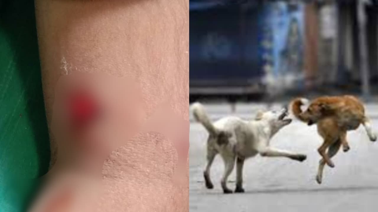 സഹോദരനെ ആശുപത്രിയിൽ കൊണ്ടുവന്നപ്പോൾ അമ്മയ്ക്കൊപ്പം വന്ന അഞ്ച് വയസുകാരനെ തെരുവുനായ കടിച്ചു സഹോദരനെ ആശുപത്രിയിൽ കൊണ്ടുവന്നപ്പോൾ അമ്മയ്ക്കൊപ്പം വന്ന അഞ്ച് വയസുകാരനെ തെരുവുനായ കടിച്ചു