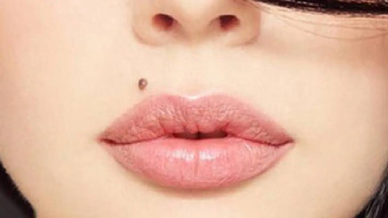 mole on lip mole on lip